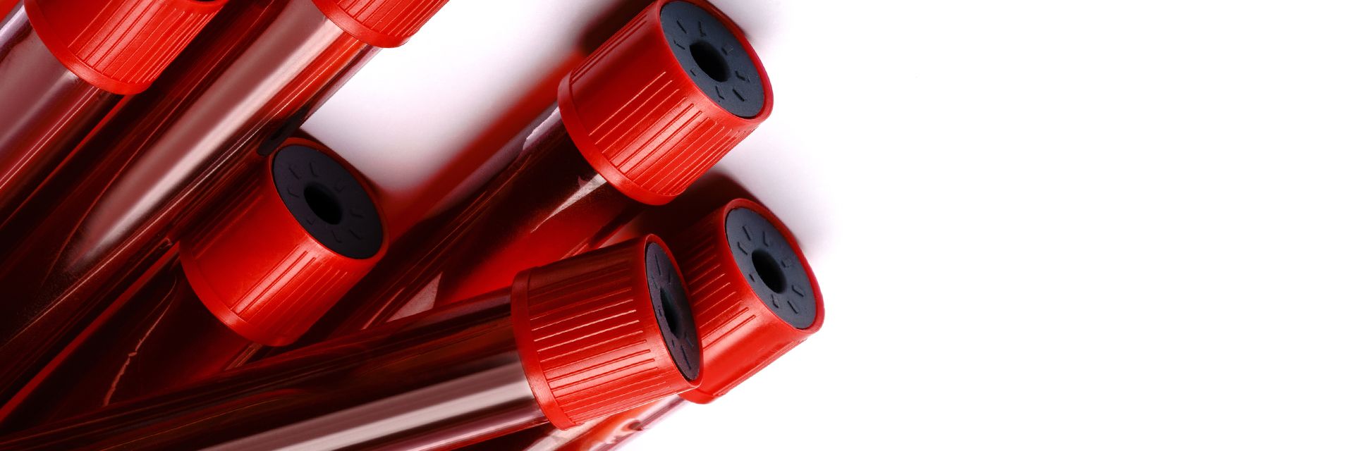 Mantenha o colesterol trabalhando a seu favor