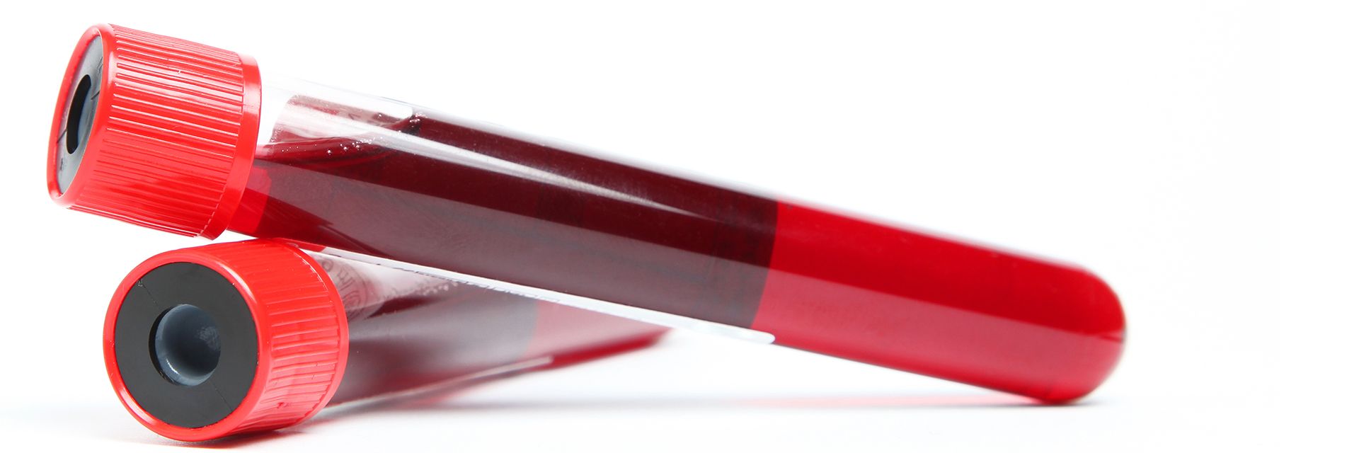 Zika: cobertura obrigatória para exames de detecção do vírus já está valendo